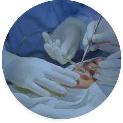 歯の治療をしている写真