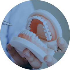 歯の模型の写真